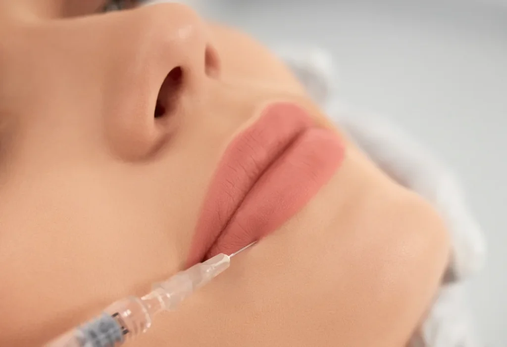 Fillers in Amsterdam